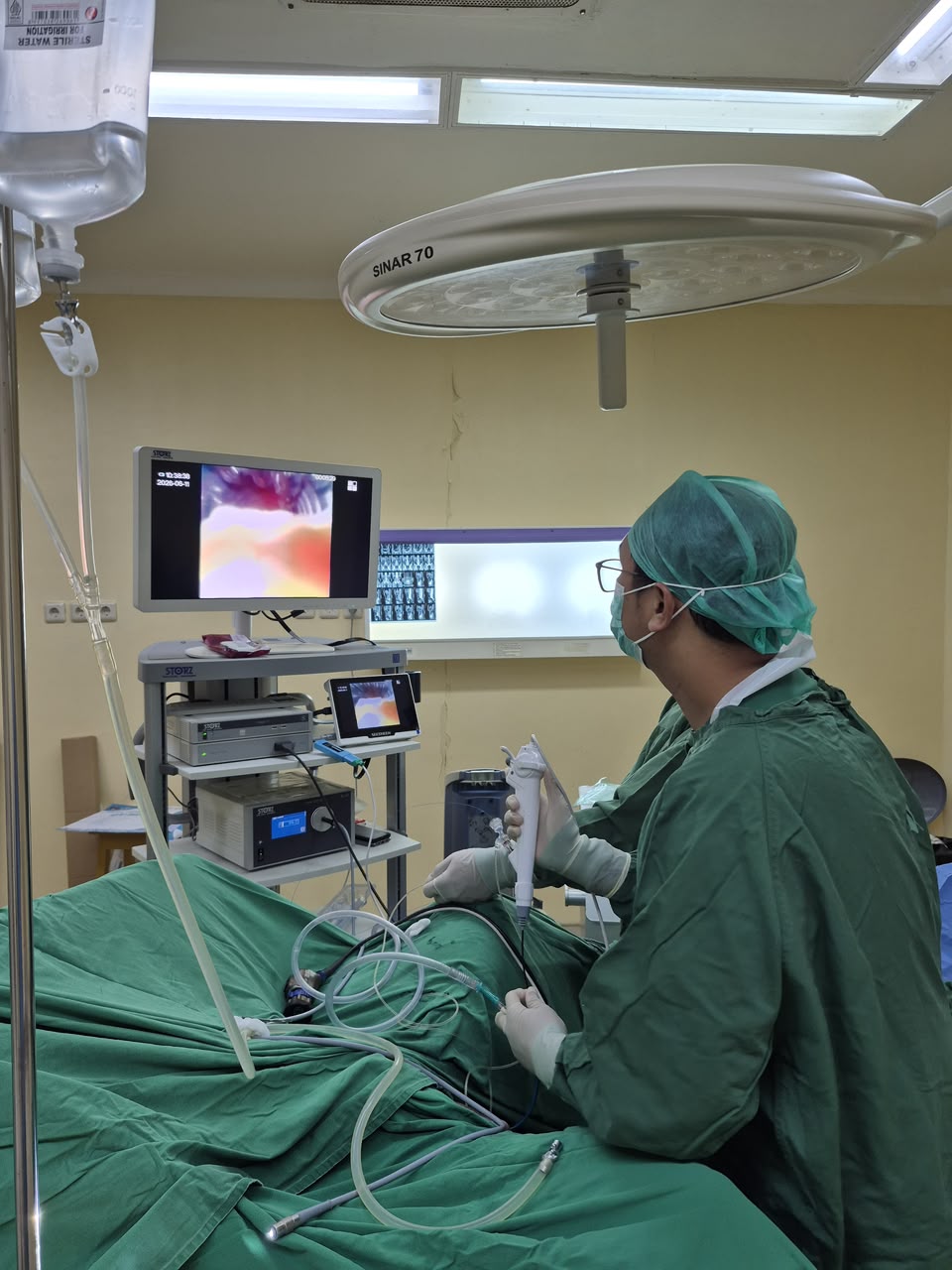 Operasi Batu Saluran Kemih Tanpa Sayatan, Layanan Urologi RSUD Ngudi Waluyo Wlingi Andalkan Teknik Minimal Invasive Surgery